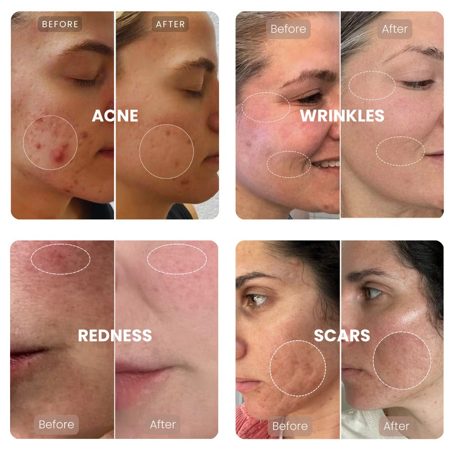 SheDiary® Advanced Glutathione Brightening Serum