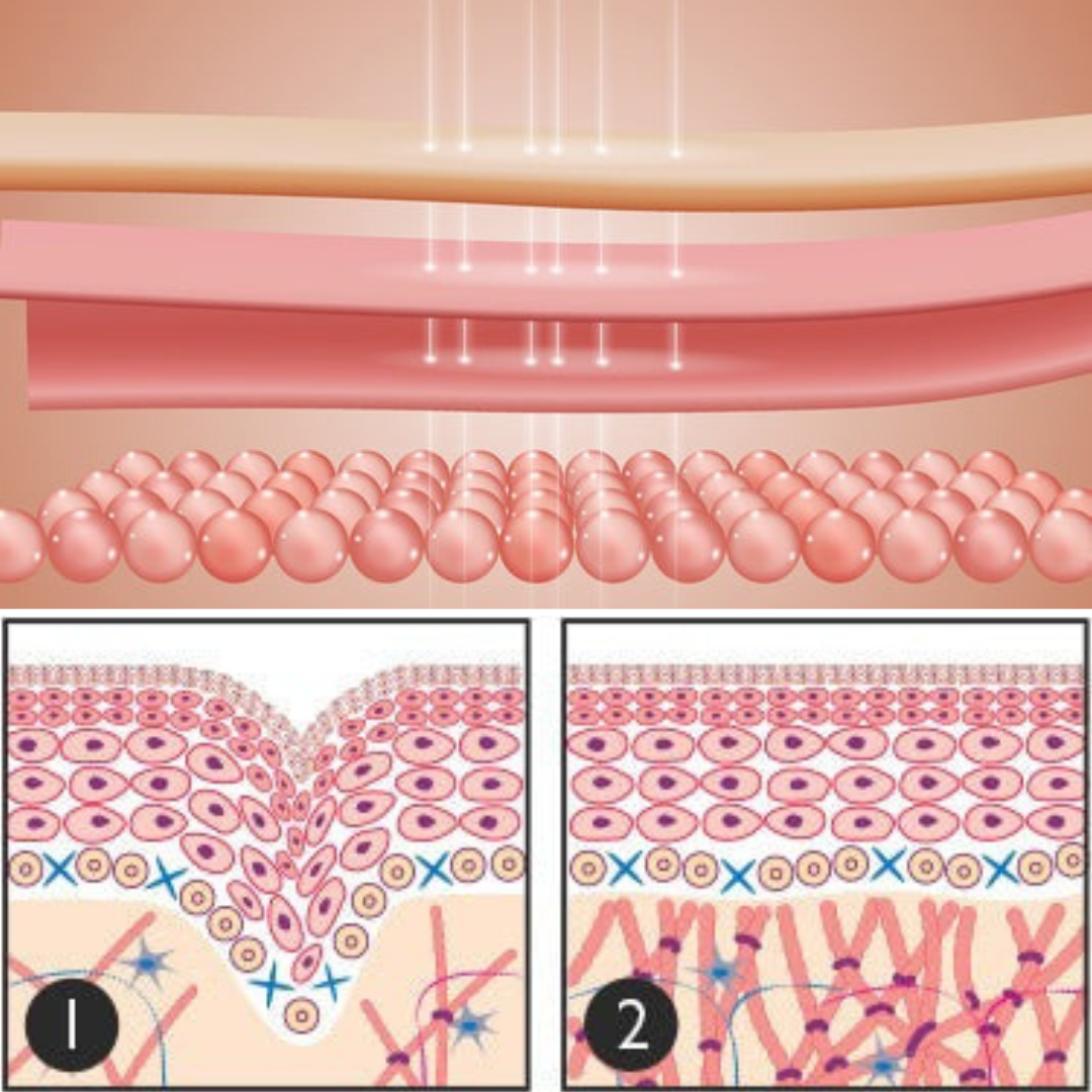 تأثير سيروم SheDiary على طبقات البشرة
